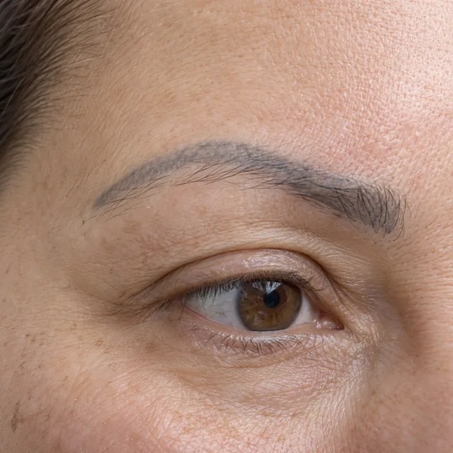 Sobrancelha com pigmentação cosmética antiga azul-acinzentada sob pelos naturais